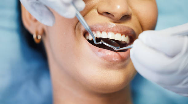 Best Urgent Care for Lost Fillings or Crowns in USA